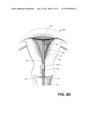 SYSTEMS AND METHODS FOR ENDOMETRIAL ABLATION diagram and image