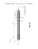 SYSTEMS AND METHODS FOR ENDOMETRIAL ABLATION diagram and image