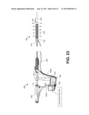 SYSTEMS AND METHODS FOR ENDOMETRIAL ABLATION diagram and image