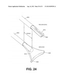 SYSTEMS AND METHODS FOR ENDOMETRIAL ABLATION diagram and image