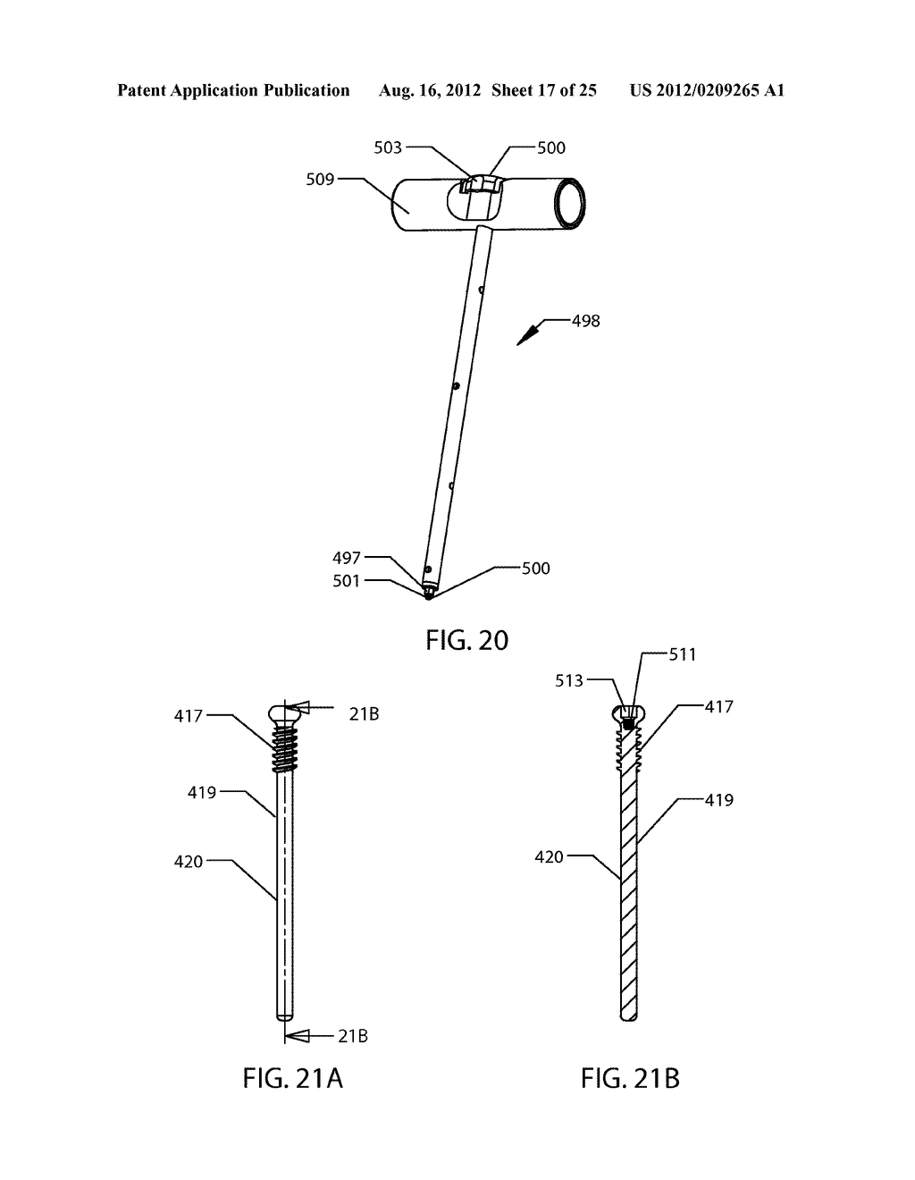 SYSTEM AND METHOD FOR ALTERING ROTATIONAL ALIGNMENT OF BONE SECTIONS - diagram, schematic, and image 18