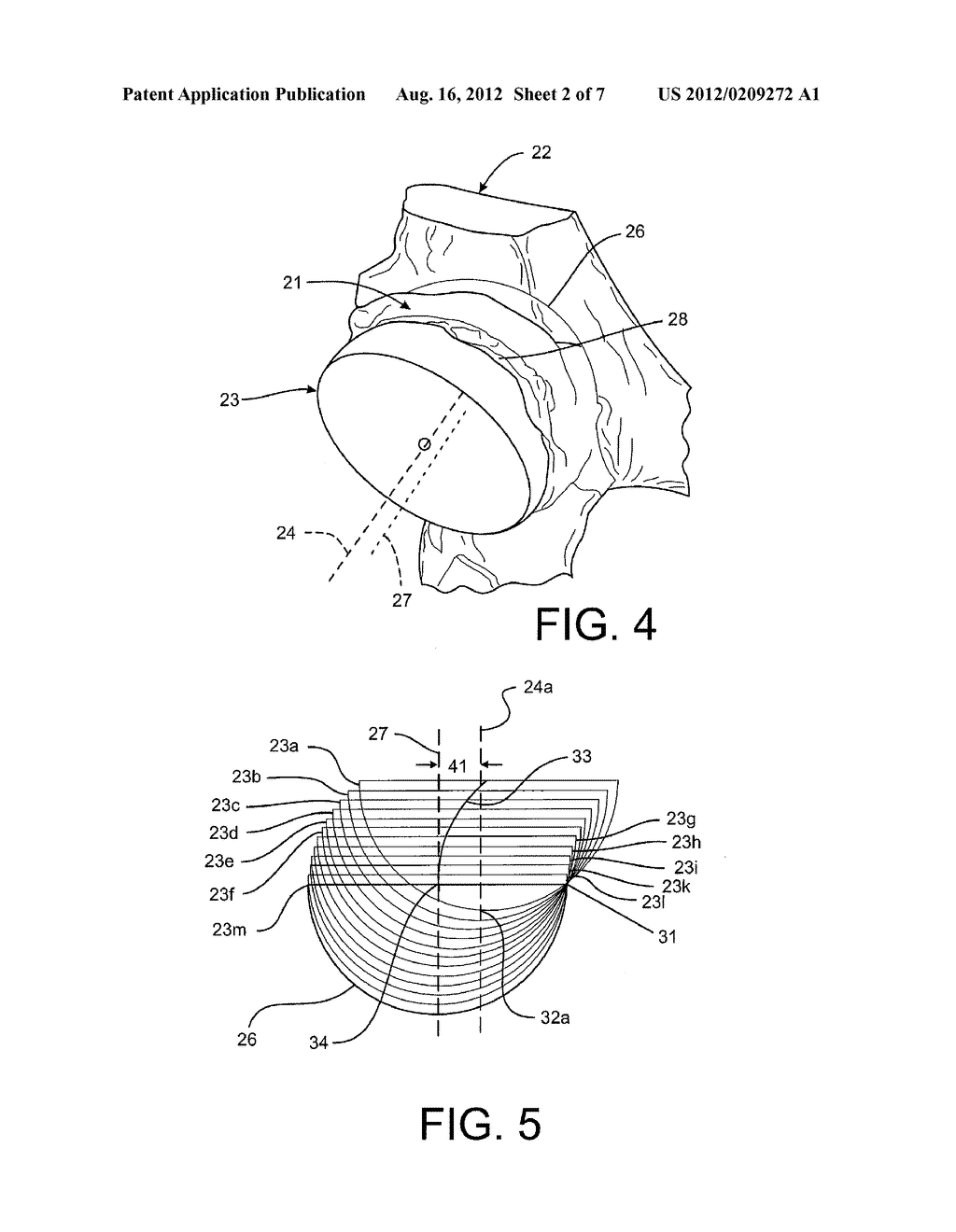 Haptic Volumes for Reaming During Arthroplasty - diagram, schematic, and image 03