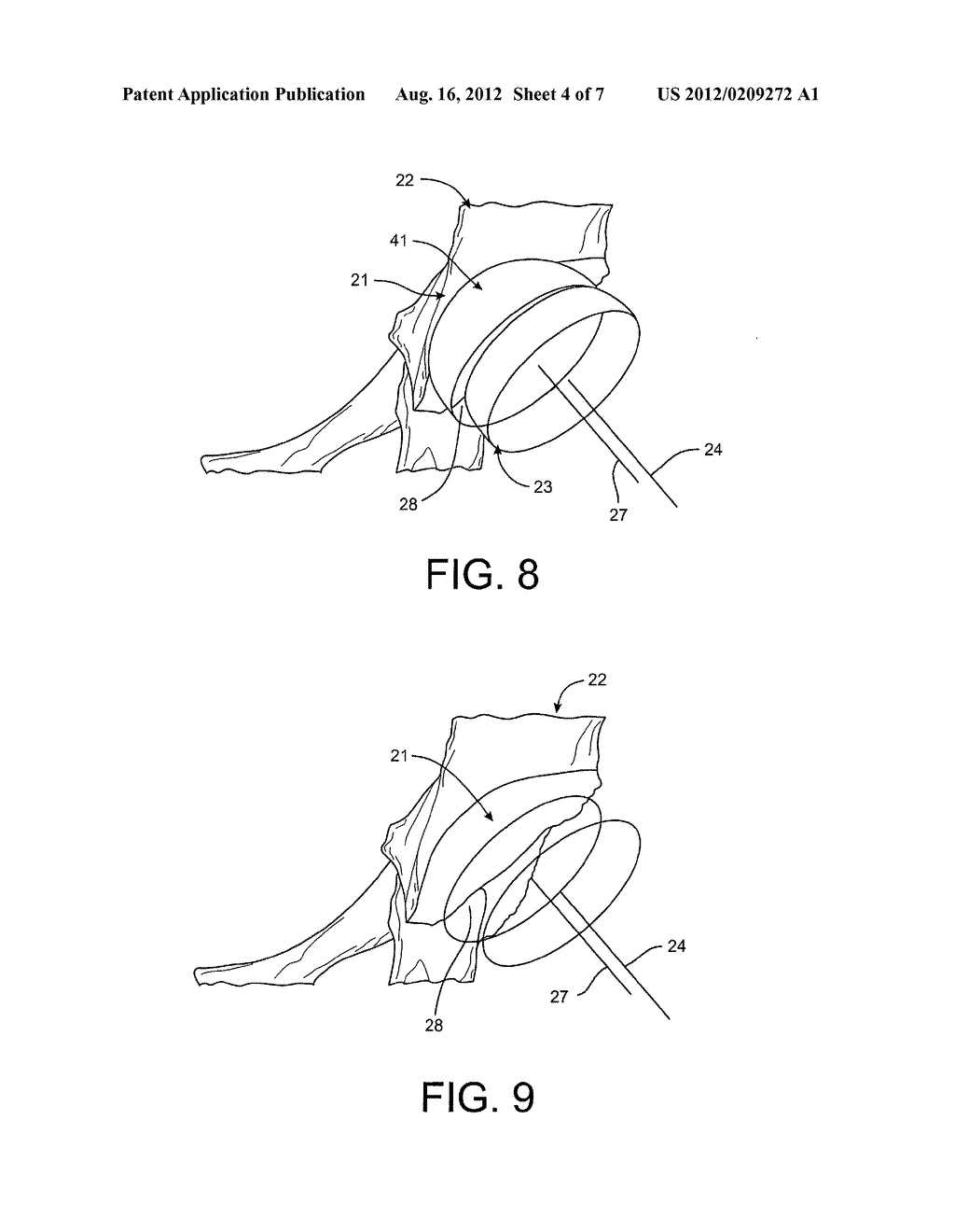 Haptic Volumes for Reaming During Arthroplasty - diagram, schematic, and image 05