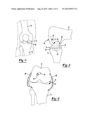 METHOD AND APPARATUS FOR PERFORMING KNEE ARTHROPLASTY diagram and image