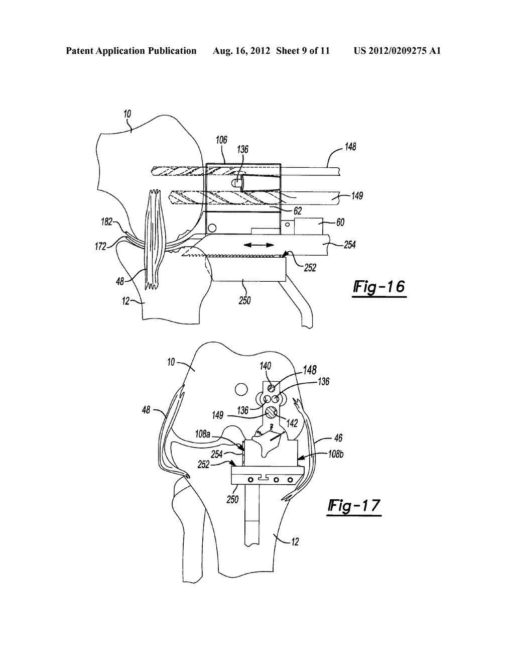 METHOD AND APPARATUS FOR PERFORMING KNEE ARTHROPLASTY - diagram, schematic, and image 10