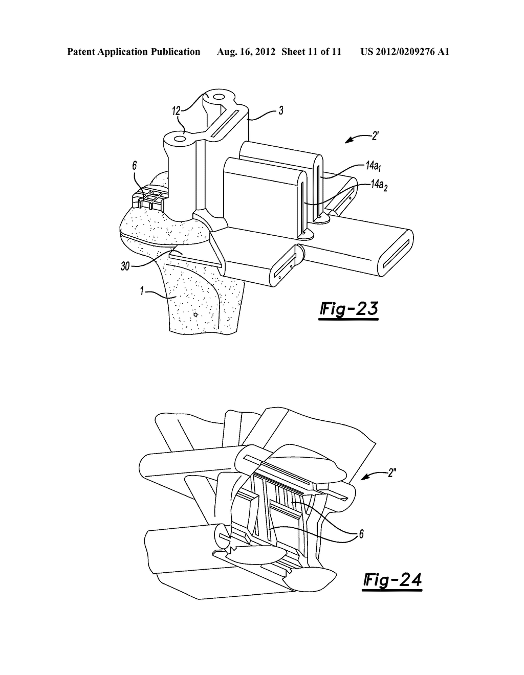 DEVICE FOR THE RESECTION OF BONES, METHOD FOR PRODUCING SUCH A DEVICE,     ENDOPROSTHESIS SUITED FOR THIS PURPOSE AND METHOD FOR PRODUCING SUCH AN     ENDOPROSTHESIS - diagram, schematic, and image 12