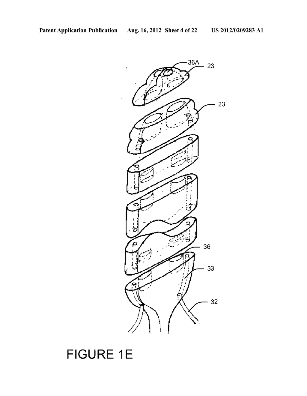 Needle and lead and methods of use - diagram, schematic, and image 05