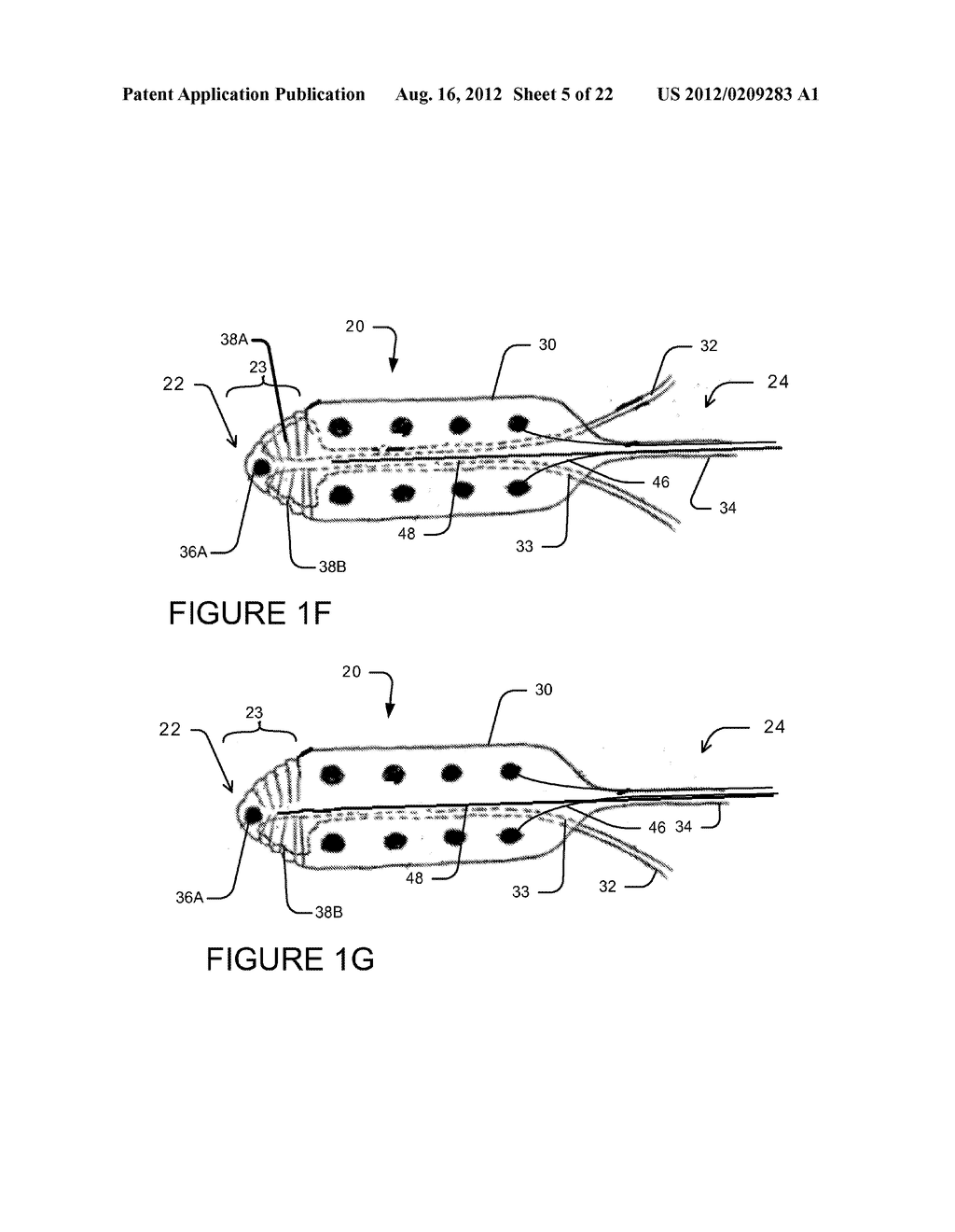 Needle and lead and methods of use - diagram, schematic, and image 06