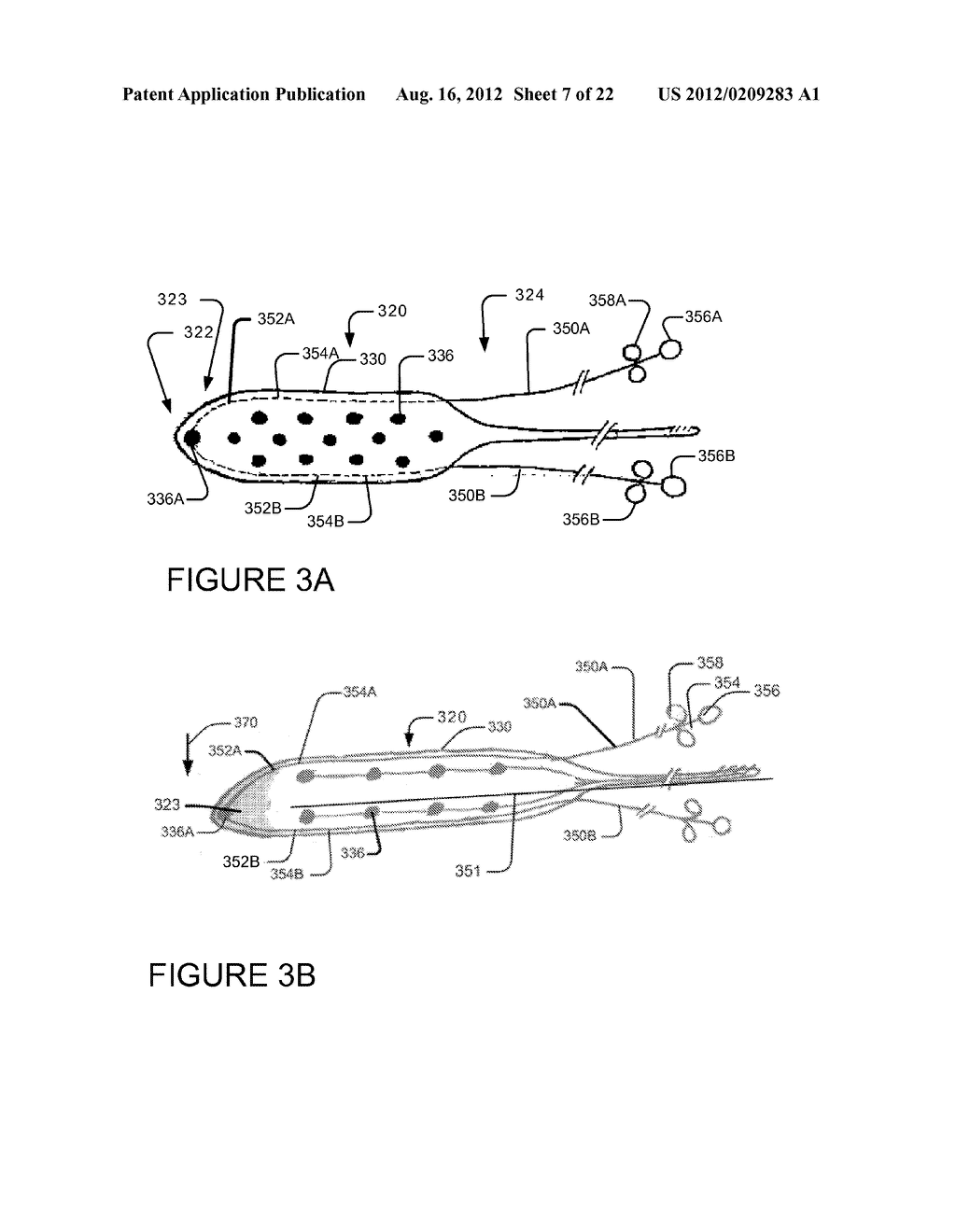 Needle and lead and methods of use - diagram, schematic, and image 08