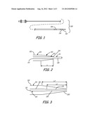 Medical Lead and Implantation diagram and image