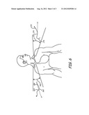 Medical Lead and Implantation diagram and image