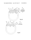 SYSTEMS AND METHODS FOR IMPLANTING PADDLE LEAD ASSEMBLIES OF ELECTRICAL     STIMULATION SYSTEMS diagram and image