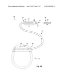 SYSTEMS AND METHODS FOR IMPLANTING PADDLE LEAD ASSEMBLIES OF ELECTRICAL     STIMULATION SYSTEMS diagram and image