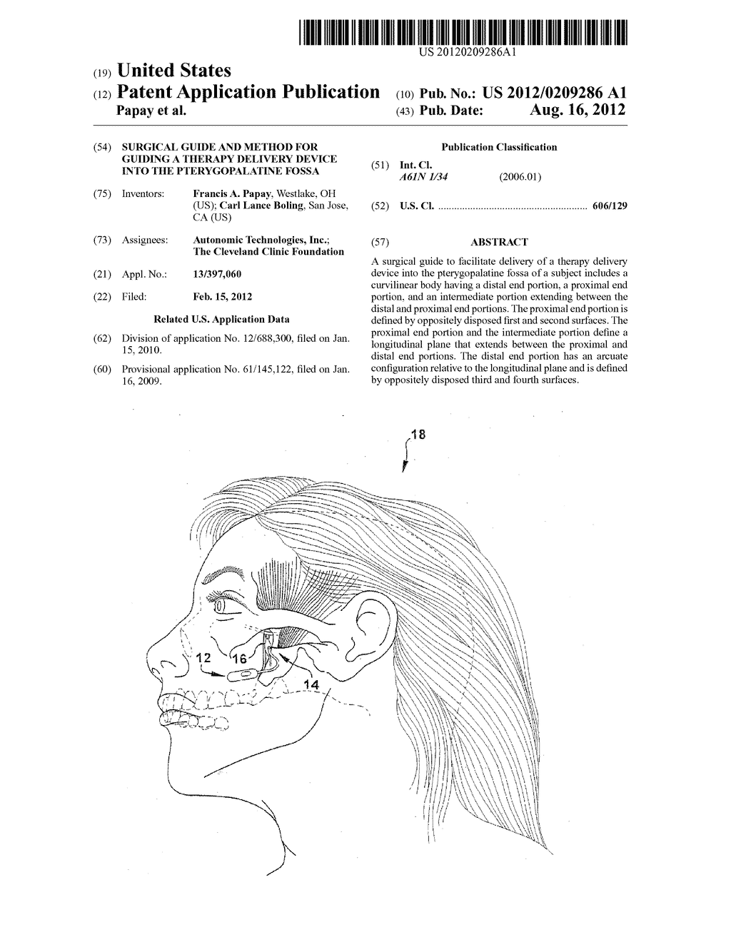 SURGICAL GUIDE AND METHOD FOR GUIDING A THERAPY DELIVERY DEVICE INTO THE     PTERYGOPALATINE FOSSA - diagram, schematic, and image 01