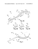 SURGICAL GUIDE AND METHOD FOR GUIDING A THERAPY DELIVERY DEVICE INTO THE     PTERYGOPALATINE FOSSA diagram and image