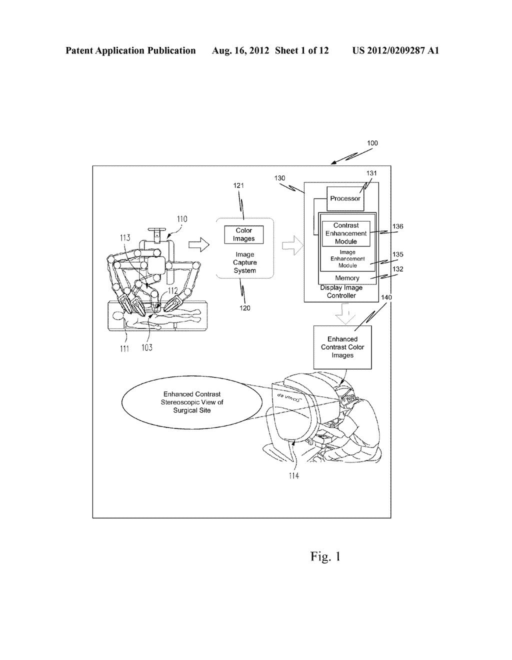 METHOD AND STRUCTURE FOR IMAGE LOCAL CONTRAST ENHANCEMENT - diagram, schematic, and image 02