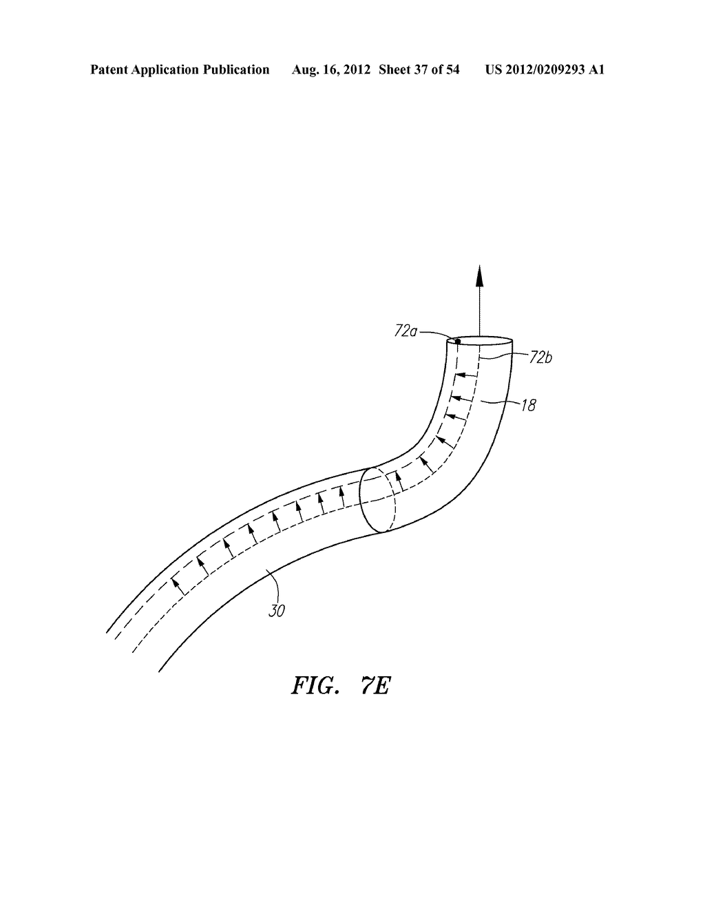 Robotic catheter systems and methods - diagram, schematic, and image 38