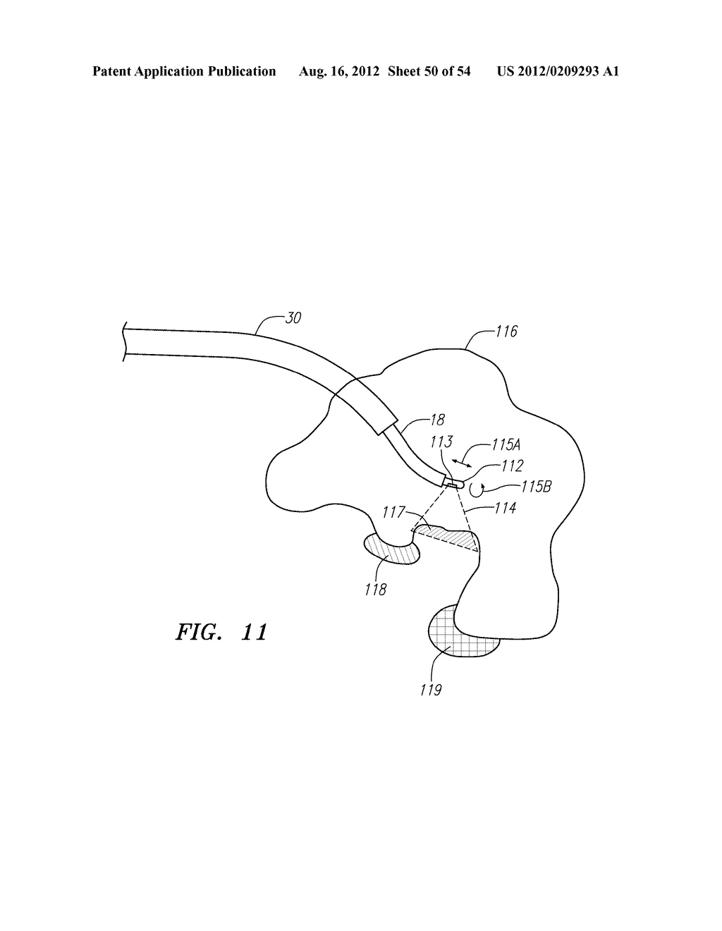 Robotic catheter systems and methods - diagram, schematic, and image 51