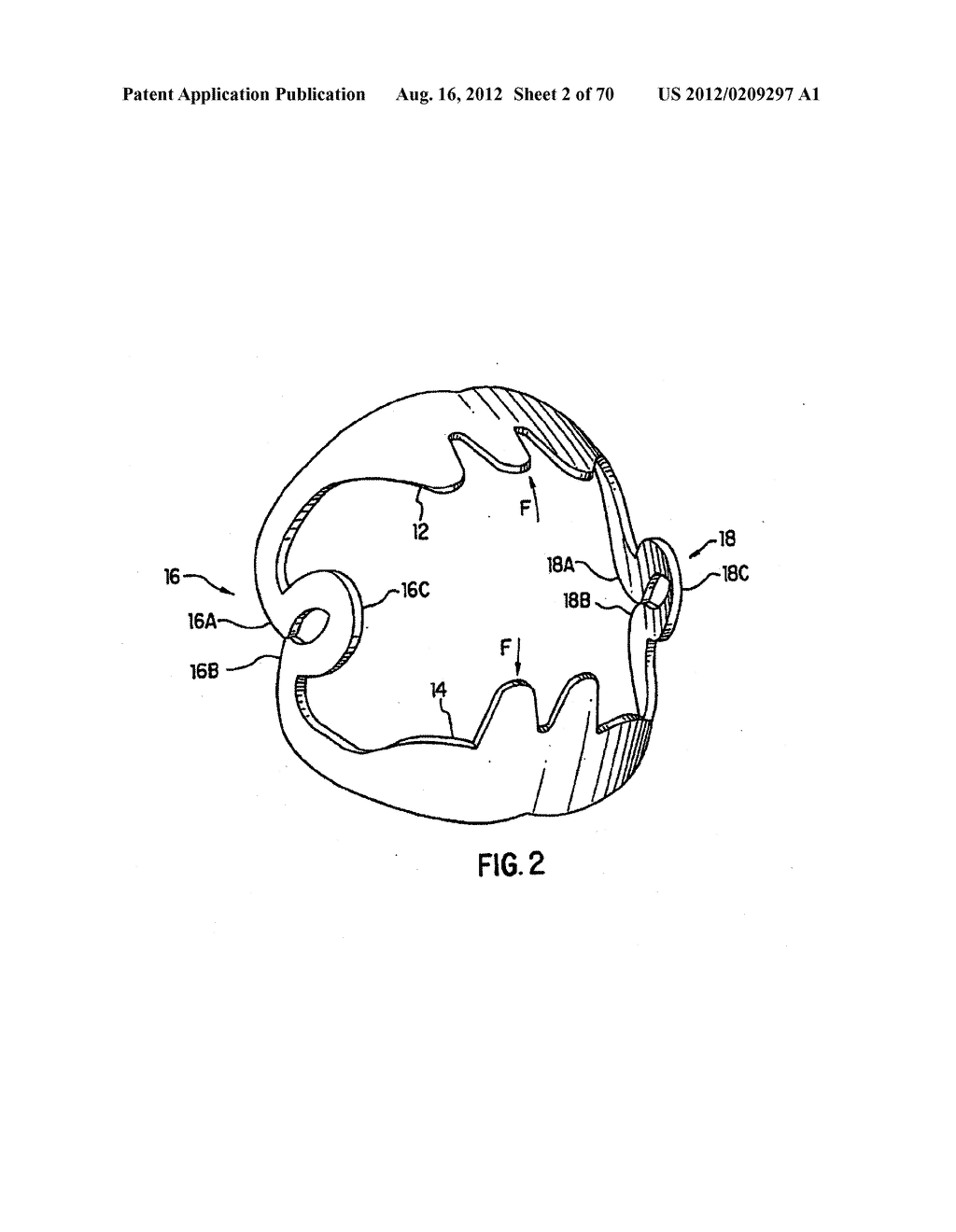 Apparatus and Method for Compressing Body Tissue - diagram, schematic, and image 03