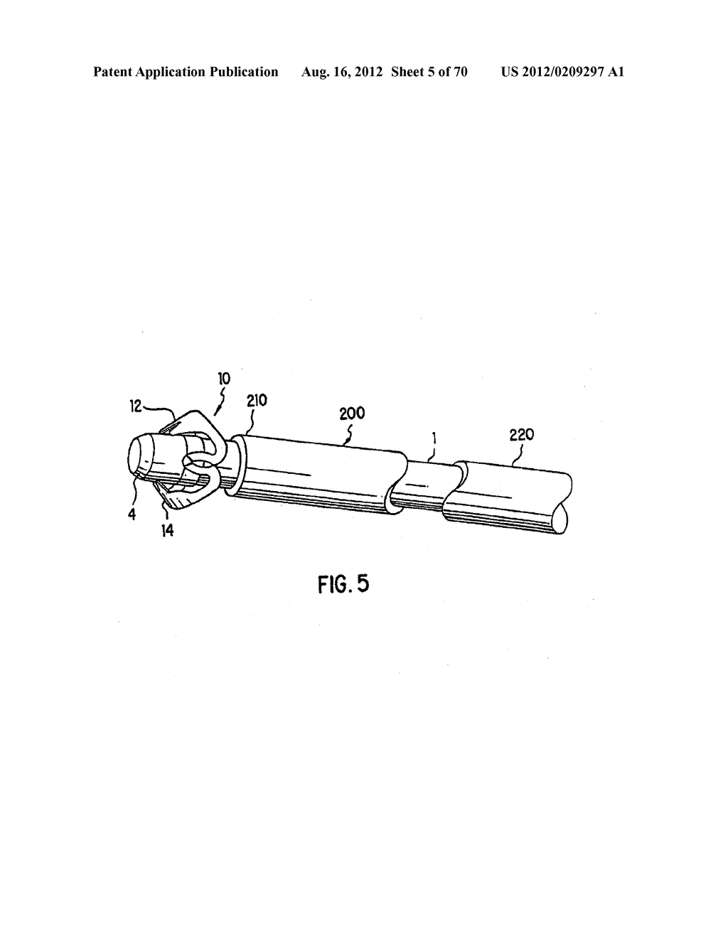 Apparatus and Method for Compressing Body Tissue - diagram, schematic, and image 06