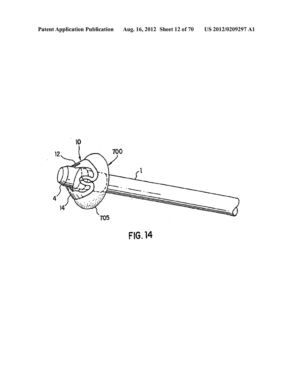 Apparatus and Method for Compressing Body Tissue - diagram, schematic, and image 13