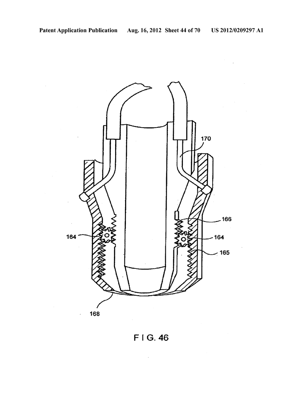 Apparatus and Method for Compressing Body Tissue - diagram, schematic, and image 45