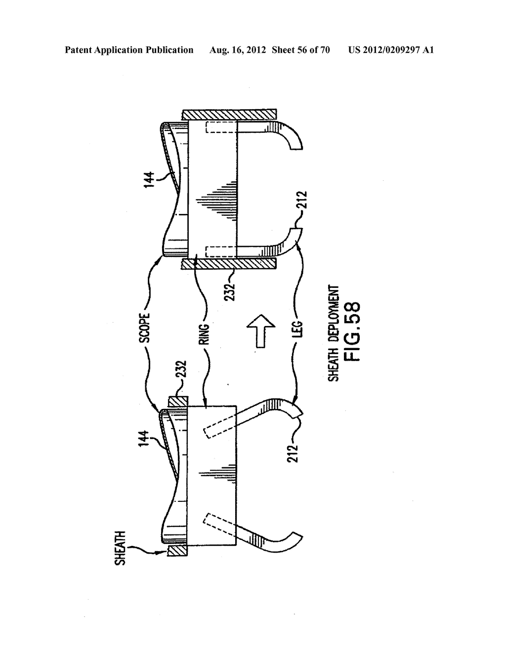 Apparatus and Method for Compressing Body Tissue - diagram, schematic, and image 57
