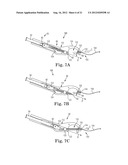 SUTURE SYSTEM AND ASSEMBLY INCLUDING A SUTURE CLIP diagram and image