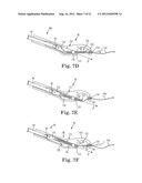 SUTURE SYSTEM AND ASSEMBLY INCLUDING A SUTURE CLIP diagram and image