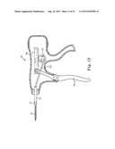 SUTURE SYSTEM AND ASSEMBLY INCLUDING A SUTURE CLIP diagram and image