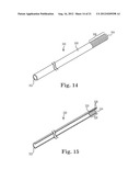 SUTURE SYSTEM AND ASSEMBLY INCLUDING A SUTURE CLIP diagram and image