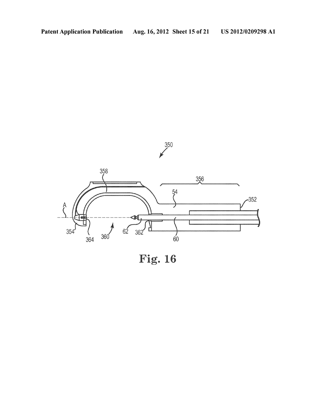 SUTURE SYSTEM AND ASSEMBLY INCLUDING A SUTURE CLIP - diagram, schematic, and image 16