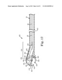 SUTURE SYSTEM AND ASSEMBLY INCLUDING A SUTURE CLIP diagram and image