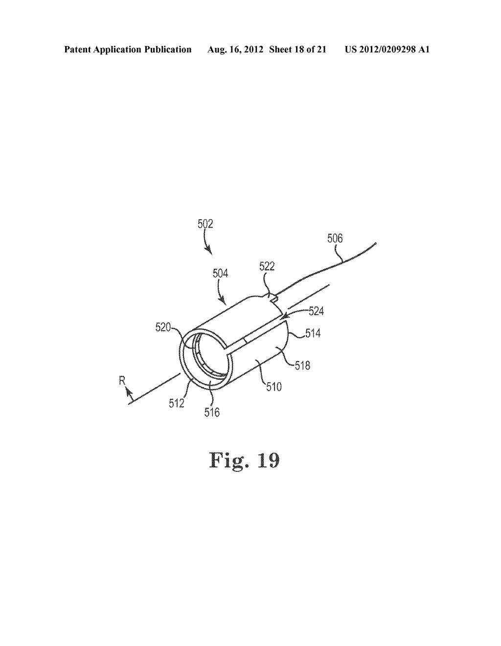 SUTURE SYSTEM AND ASSEMBLY INCLUDING A SUTURE CLIP - diagram, schematic, and image 19