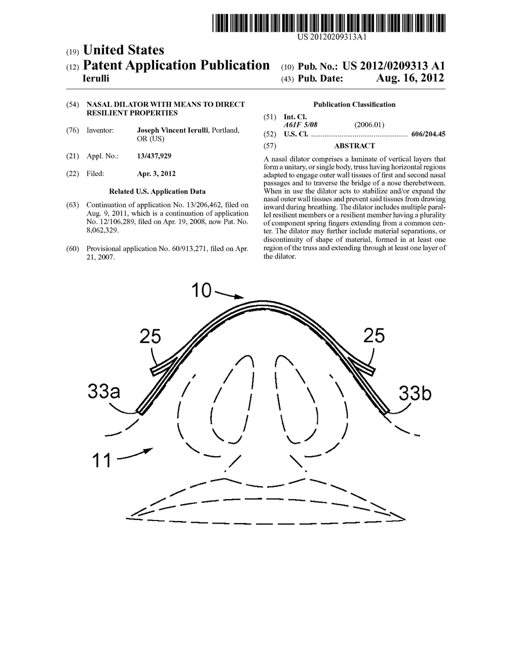 Nasal Dilator With Means To Direct Resilient Properties - diagram, schematic, and image 01