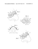 Nasal Dilator With Means To Direct Resilient Properties diagram and image