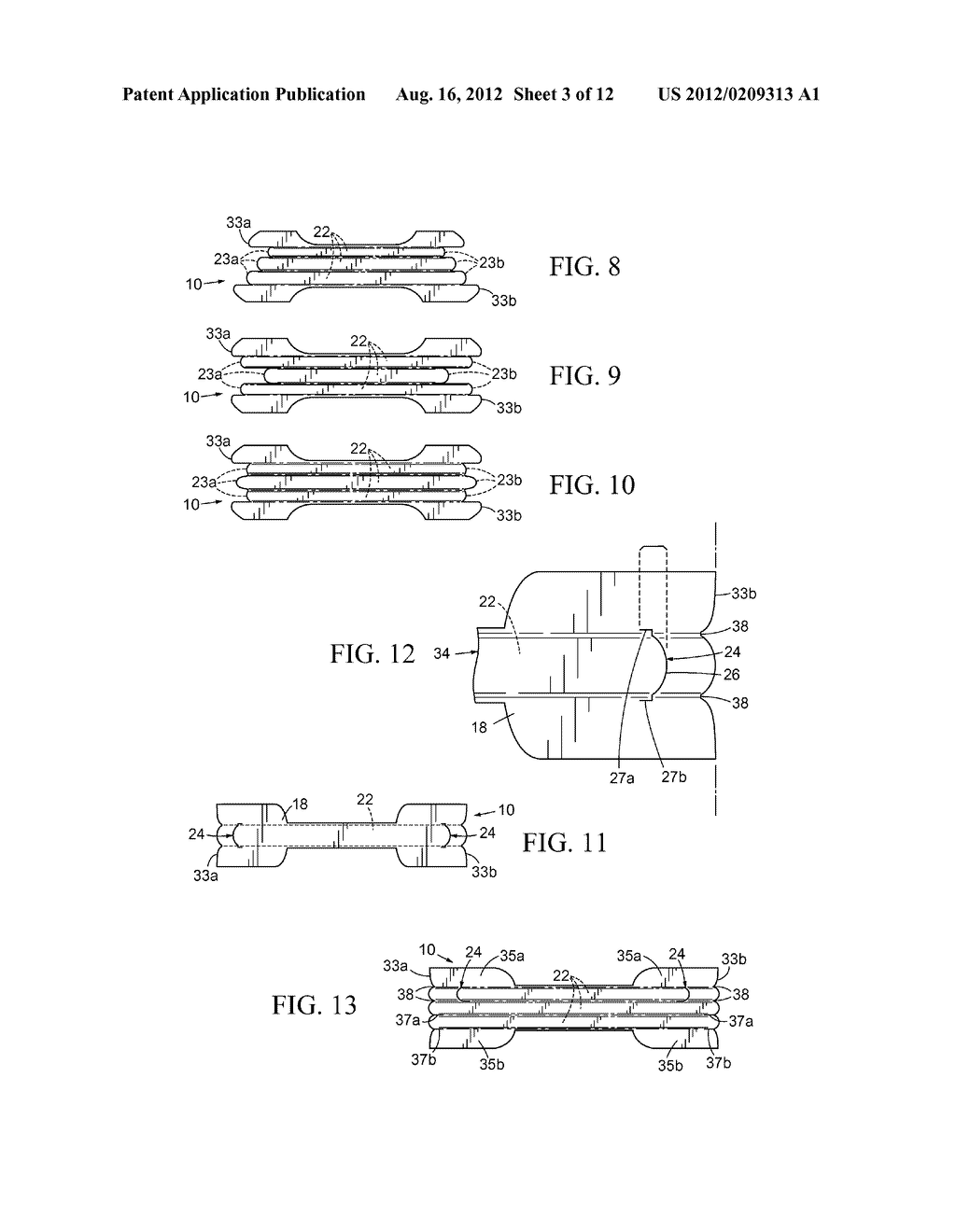 Nasal Dilator With Means To Direct Resilient Properties - diagram, schematic, and image 04