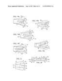 Nasal Dilator With Means To Direct Resilient Properties diagram and image