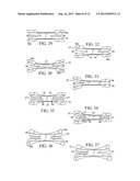 Nasal Dilator With Means To Direct Resilient Properties diagram and image