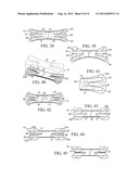 Nasal Dilator With Means To Direct Resilient Properties diagram and image