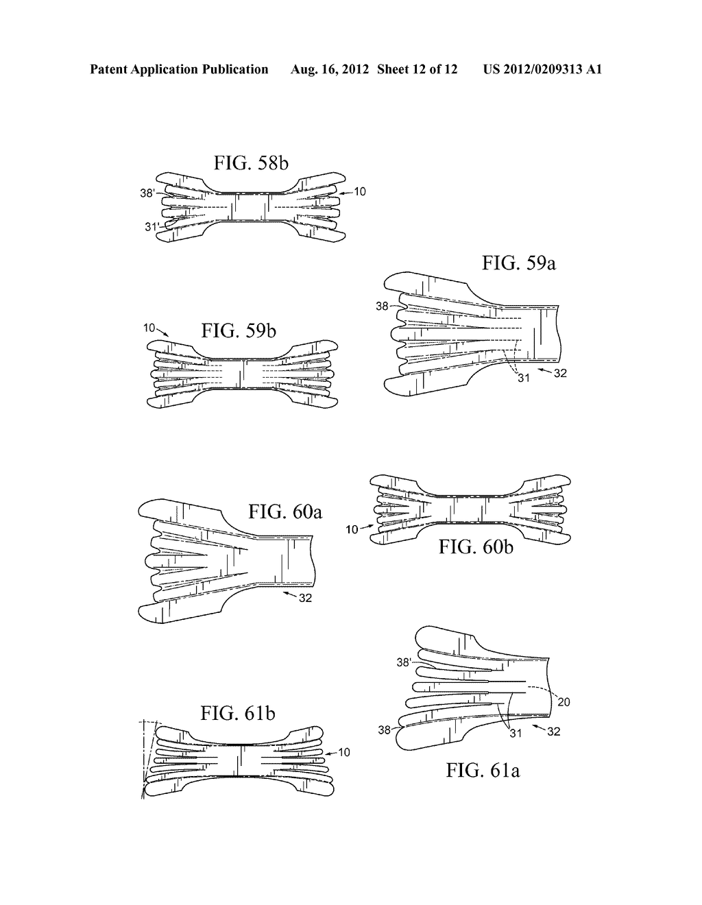 Nasal Dilator With Means To Direct Resilient Properties - diagram, schematic, and image 13