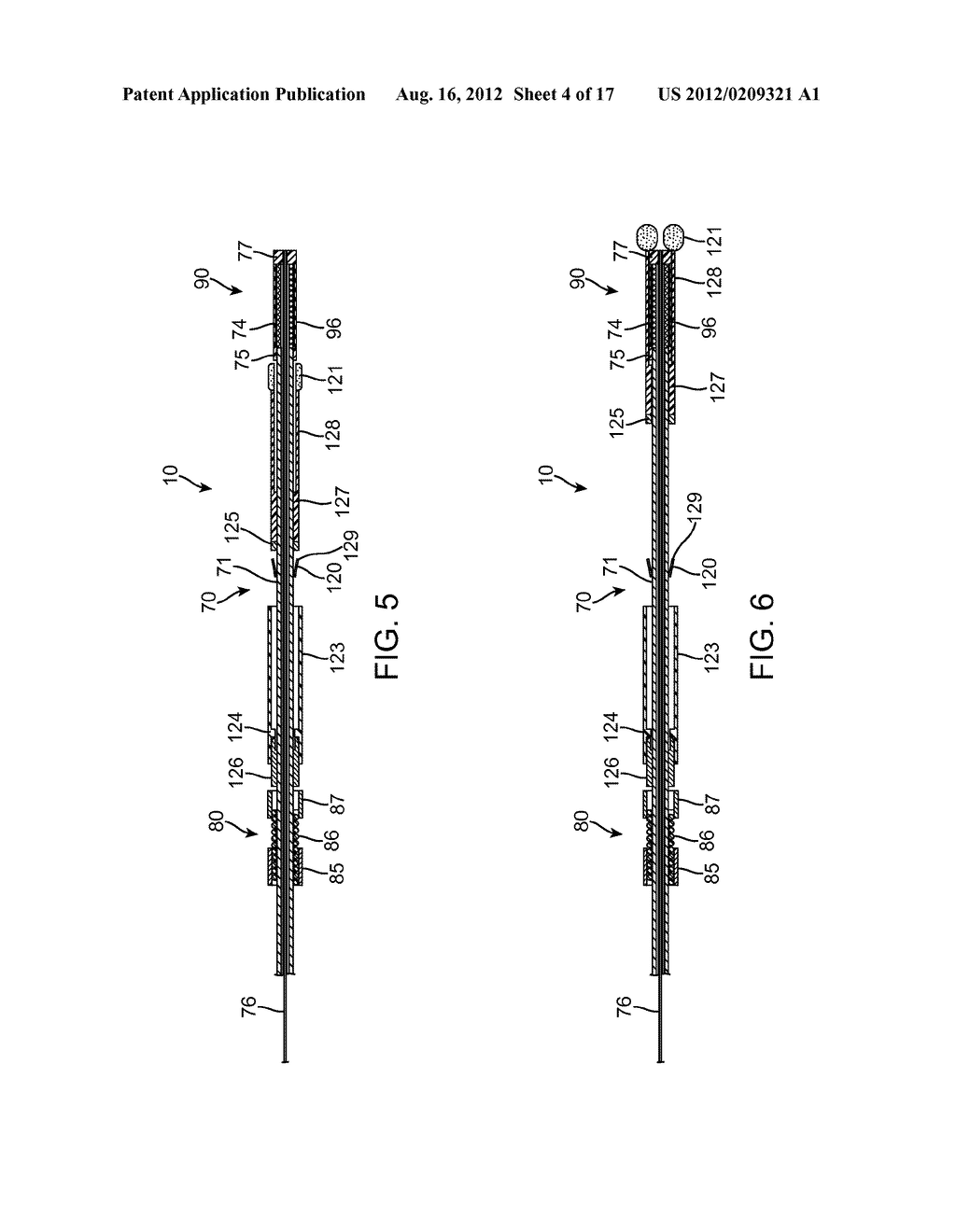 APPARATUS AND METHODS FOR DELIVERING HEMOSTATIC MATERIALS FOR BLOOD VESSEL     CLOSURE - diagram, schematic, and image 05