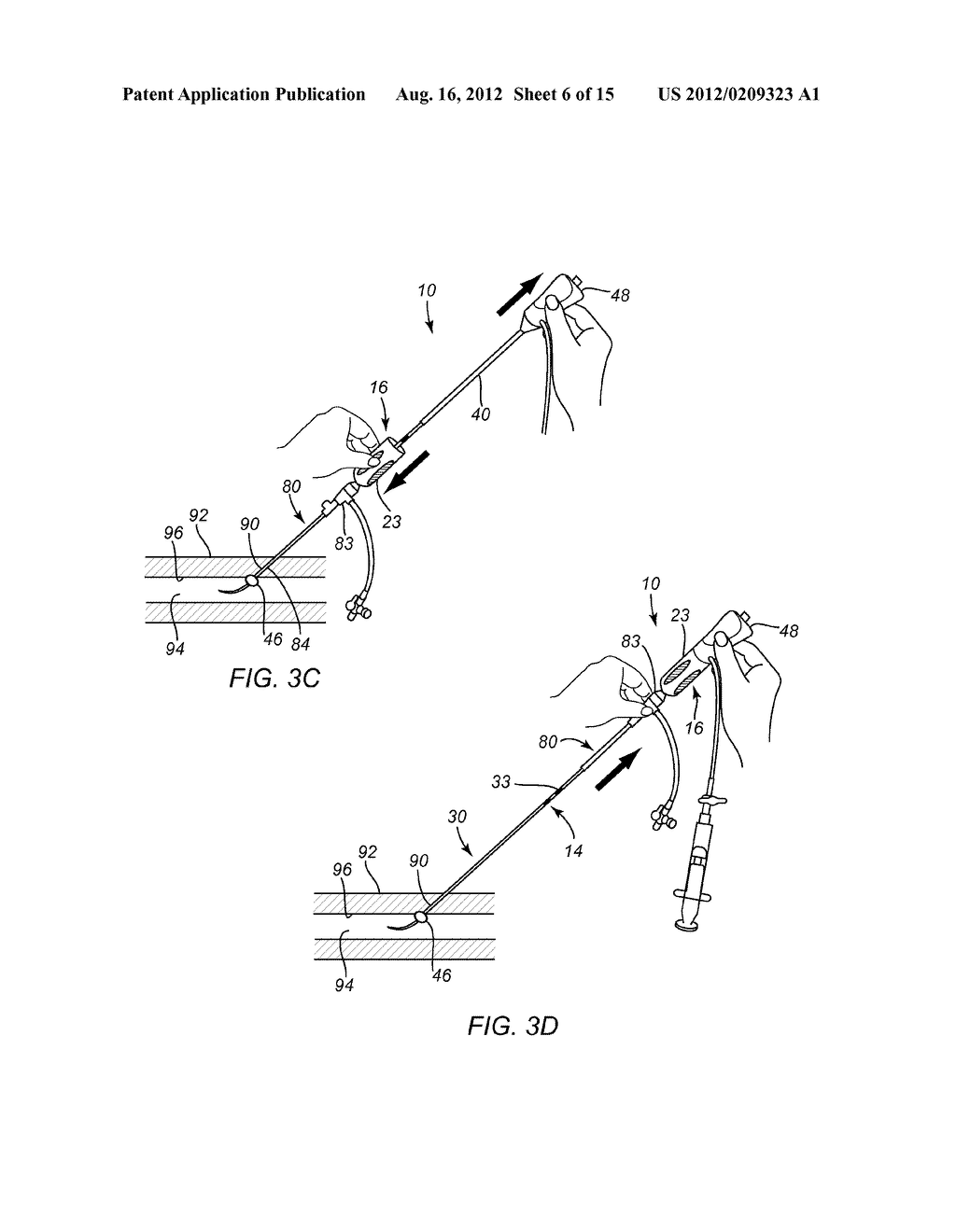 APPARATUS AND METHODS FOR SEALING A VASCULAR PUNCTURE - diagram, schematic, and image 07