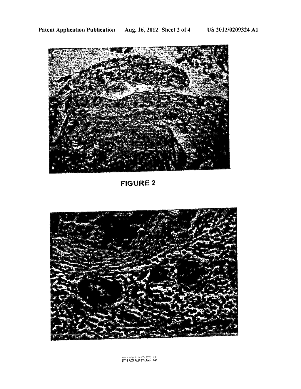 BIODEGRADABLE, NON-TOXIC BIOLOGICAL ADHESIVE FOR USE IN ABDOMINAL SURGERY - diagram, schematic, and image 03