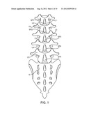 STRUCTURES AND METHODS FOR CONSTRAINING SPINAL PROCESSES WITH SINGLE     CONNECTOR diagram and image