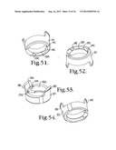 Polyaxial bone anchor with pop-on shank, friction fit retainer and winged     insert diagram and image