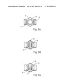 METHOD FOR THE TREATMENT OF GALLSTONES diagram and image