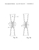 METHOD FOR THE TREATMENT OF GALLSTONES diagram and image