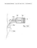 METHOD FOR THE TREATMENT OF GALLSTONES diagram and image