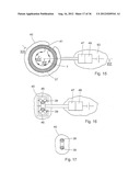 METHOD FOR THE TREATMENT OF GALLSTONES diagram and image